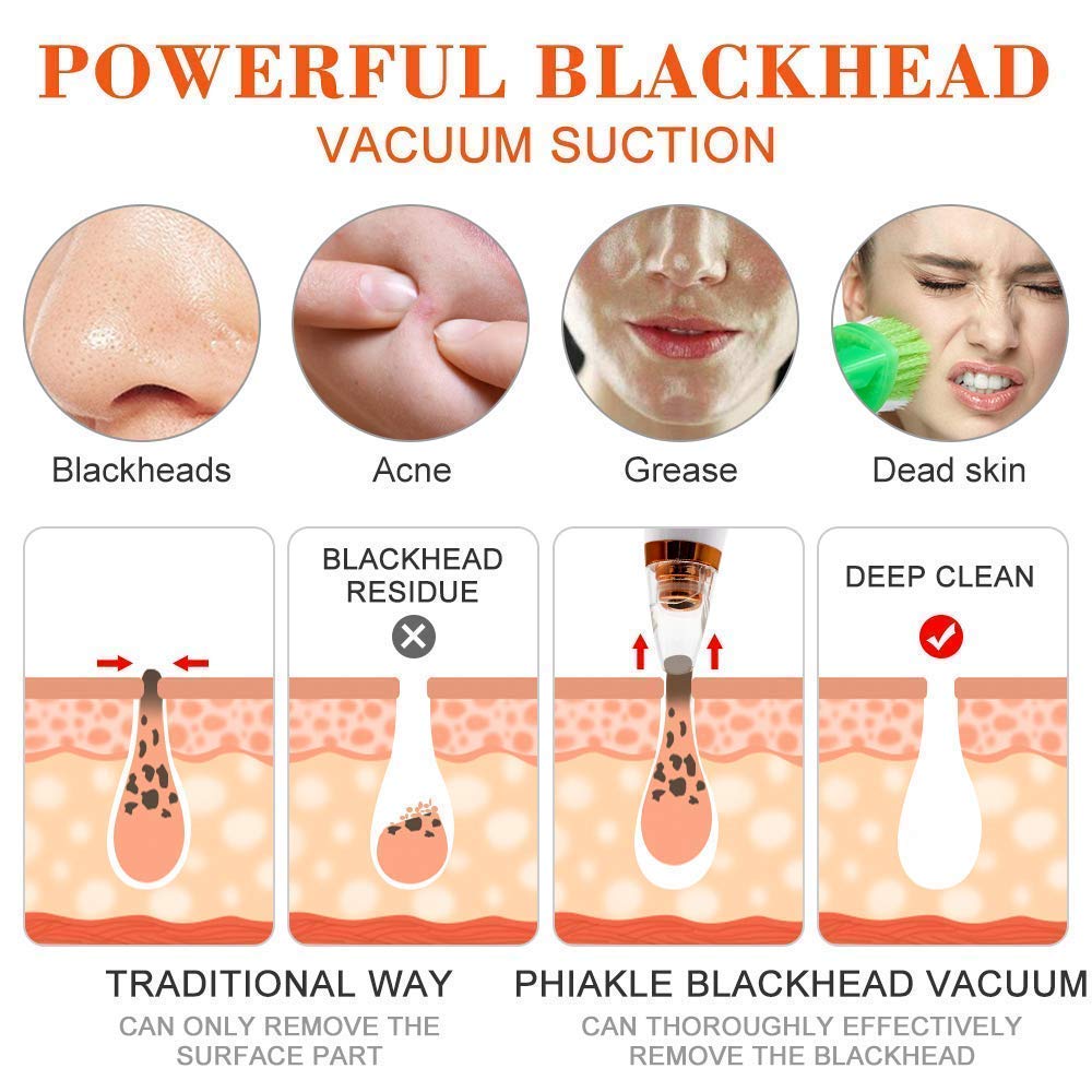 6 in 1 Multi-function Blackhead Remover Tools | Electric Derma suction Machine | USB Rechargeable Acne Pimple Pore Cleaner Vacuum tool | Facial Cleanser Device for Nose & Skin Care